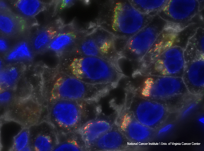 triple negative breast cancer cells